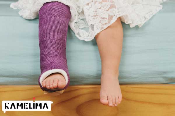 چقدر طول می کشد تا شکستگی کودکان بهبود یابد؟