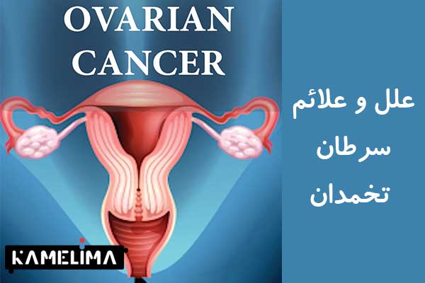 علل و علائم سرطان تخمدان یا Ovarian cancer