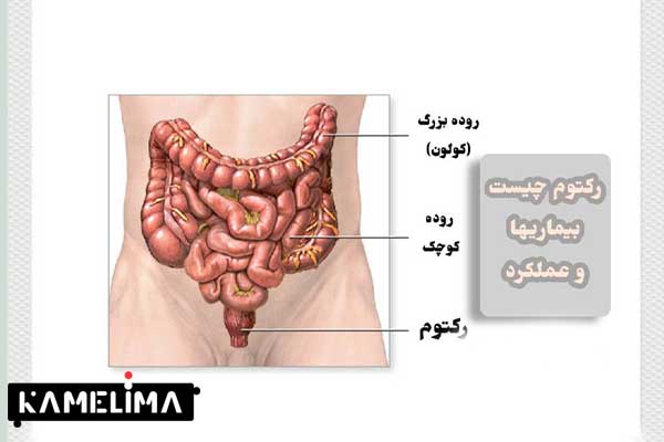 پیشگیری از افتادگی رکتوم